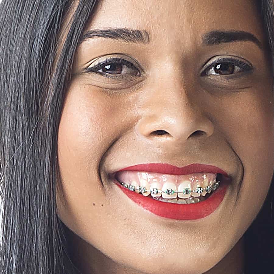 orthodontics for adults