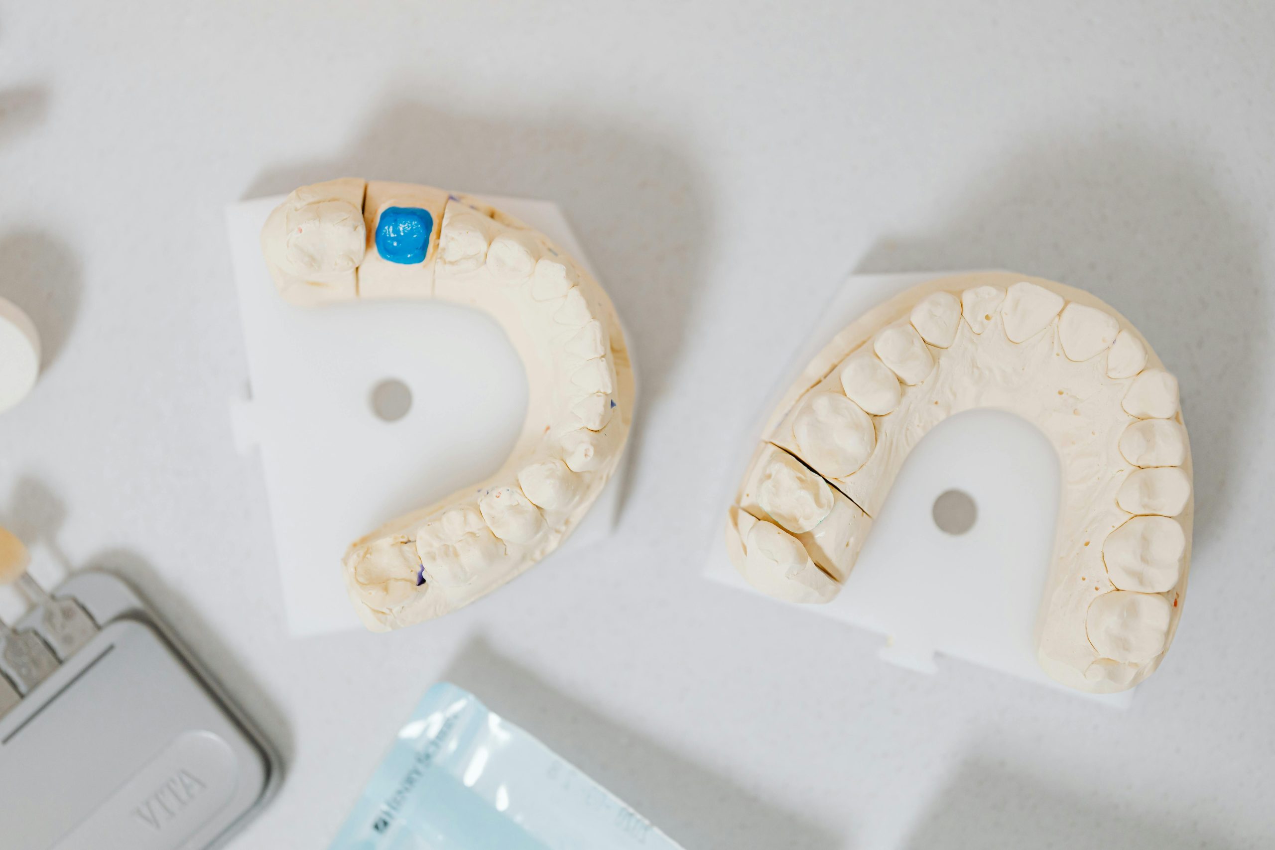 same day dental crowns chico ca